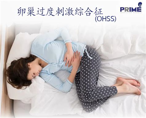 卵巢过度刺激综合征 Ohss 妇产科 试管婴儿 不孕症