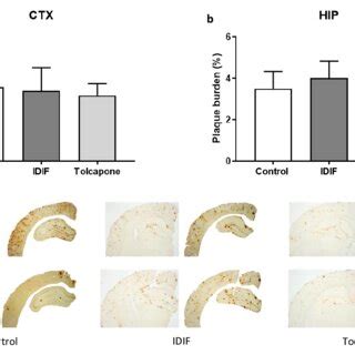 A B A Plaque Burden In The Cortex And Hippocampus Of Non Treated