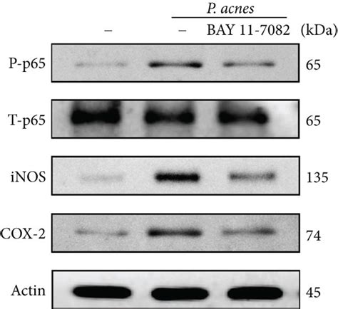 P Acnes Induced Inos No And Cox 2 Pge2 Expressions Via A Ros Dependent