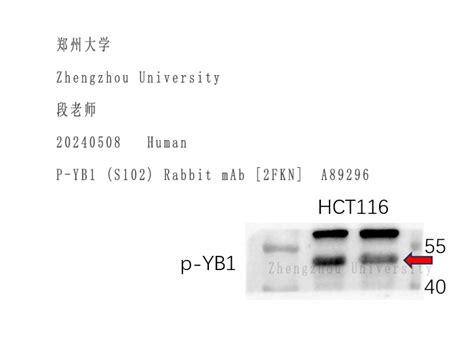 抗体试剂使用 Review 持续更新00001 Nature Biosciences kit mAb