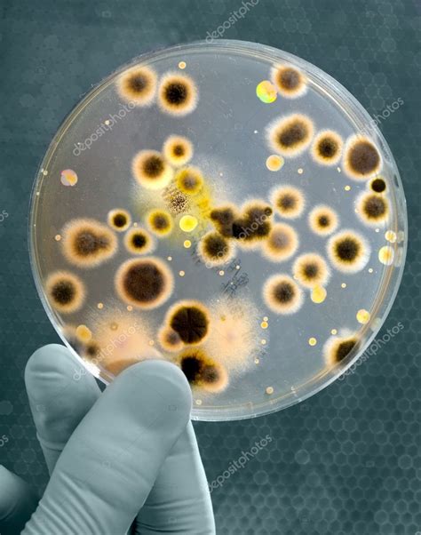 Petri Dish with Bacteria Culture Stock Photo by ©alexraths 6857994