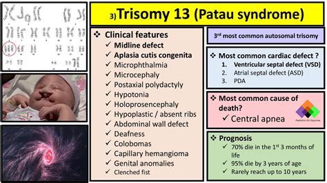 Patau Syndrome Chromosomes