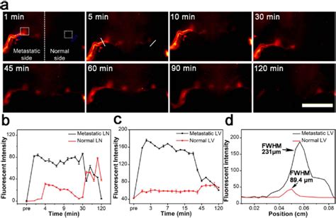 Nir Ii Fluorescence Imaging In Normal And Metastatic Lymphatic Systems