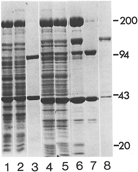 Sds Polyacrylamide Gel Electrophoresis Of Platelets And Platelet Download Scientific Diagram