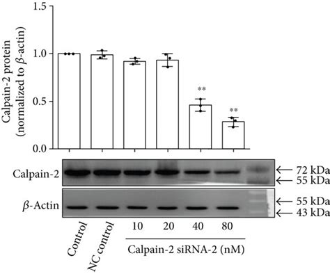 Knockdown Of Calpain 2 Inhibited Hypoxia Induced Proliferation Of