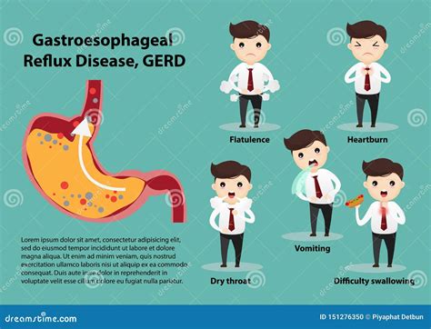 Gastro Esophageal Reflux Disease Gerd Stock Vector Illustration Of