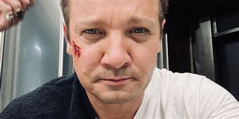 Jeremy Renner Undergoes Surgery After "Traumatic Injury"