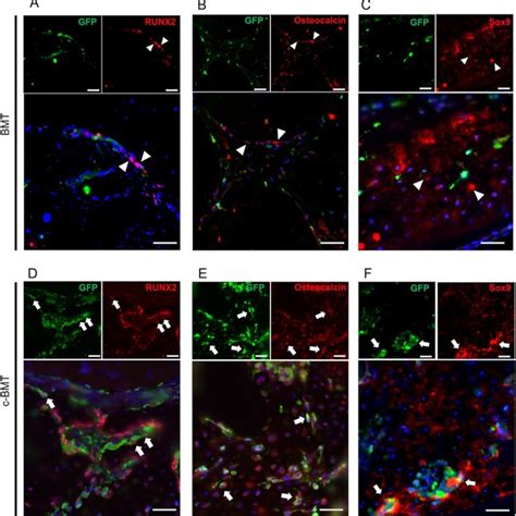 RUNX2 Stromal Cells Are Recruited In Modified Bone Marrow