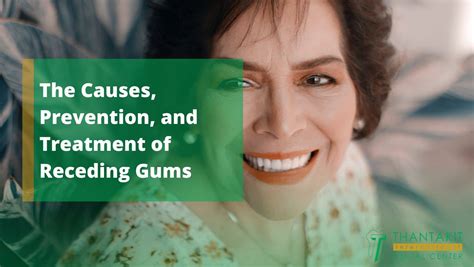 The Causes, Prevention, and Treatment of Receding Gums