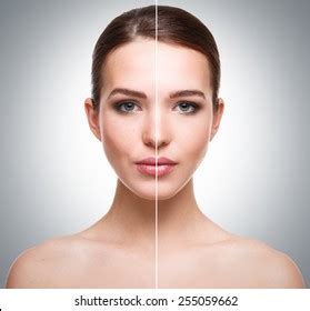 Woman Face Before After Retouch Stock Photo 255059662 | Shutterstock