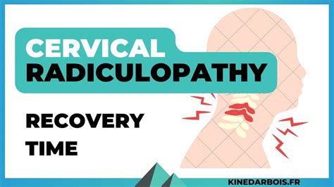 How Long Does It Take To Heal From Cervical Radiculopathy Tips