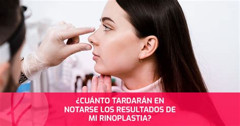 Cuál es el precio de una Mentoplastia en Lima Dr Edwin Vásquez