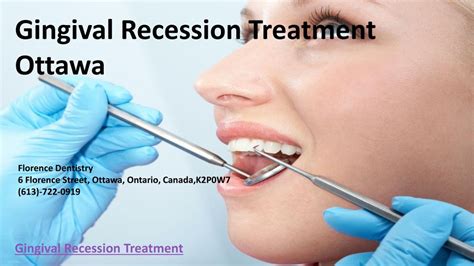 Ppt Gingival Recession Treatment Ottawa Powerpoint Presentation Free