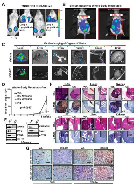 Wnt Inhibition Interferes With De Novo Whole Body Metastasis In Highly