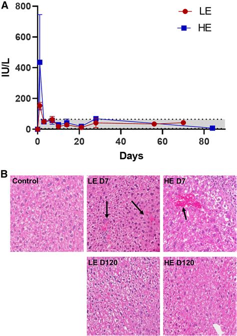 Ultrasound Mediated Gene Delivery Specifically Targets Liver Sinusoidal