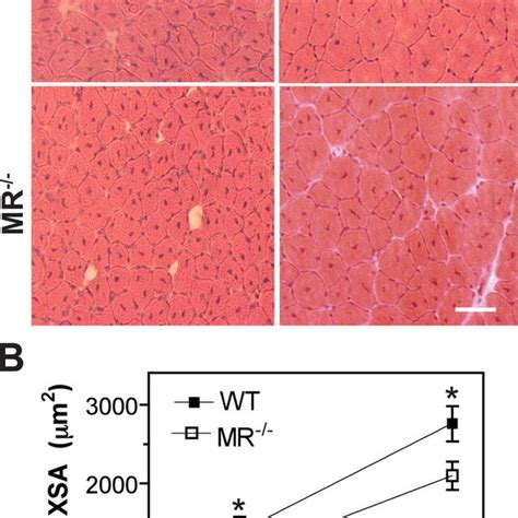 Mr Is Required For Normal Muscle Regeneration After Injury A At Days