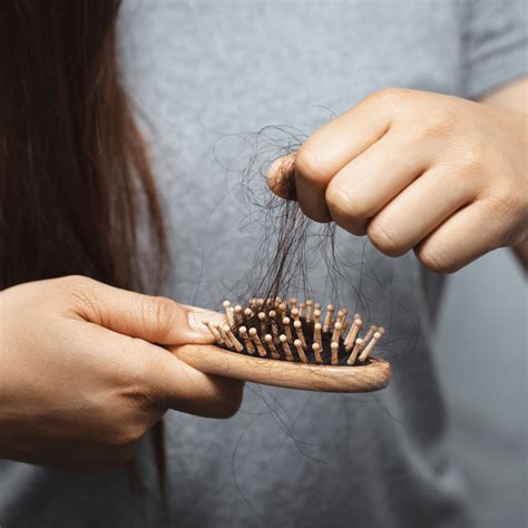 La Caída Del Pelo Y Alopecia Hospital De Día