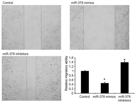 Microrna Regulates Cell Proliferation And Migration By Repressing