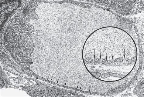 Fenestrated capillary Diagram | Quizlet