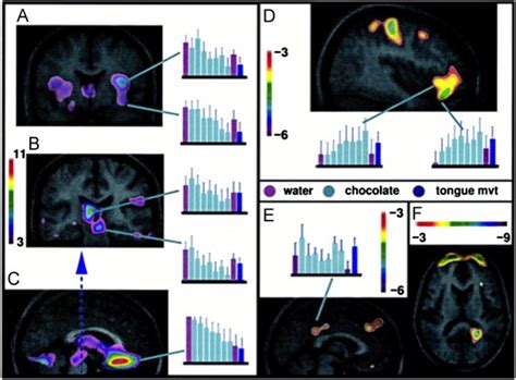 Cortical Regions Demonstrating Significant Rcbf Correlations With