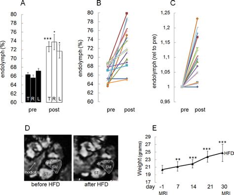 High Fat Diet Hfd Feeding Induces Expansion Of The Endolymphatic