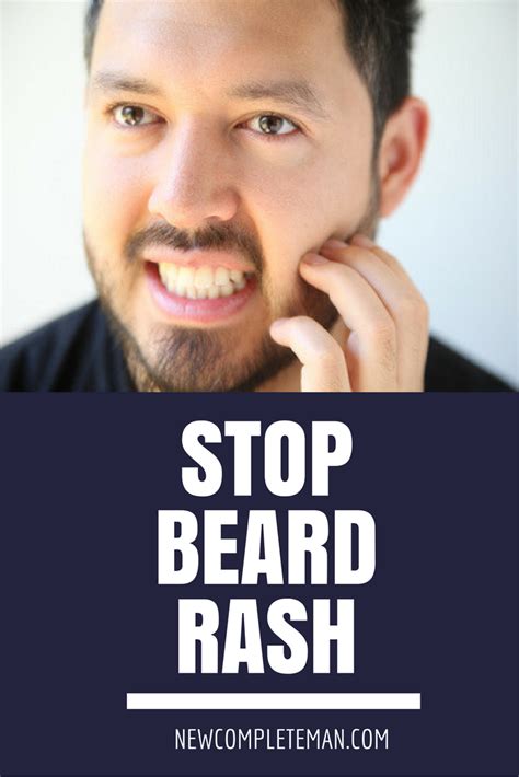 How To Stop Beard Rash For Good Beard Rash Beard Beard Care