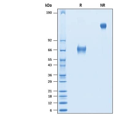 Recombinant Cynomolgus CD25 IL 2R Alpha Fc Protein CF 10721 RL By R