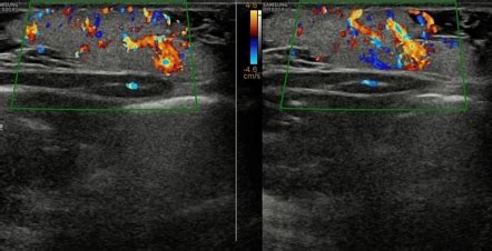 Image Radiopaedia Org