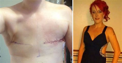 Brave Mum Diagnosed With Cancer At 26 Sacrifices Both Breasts And