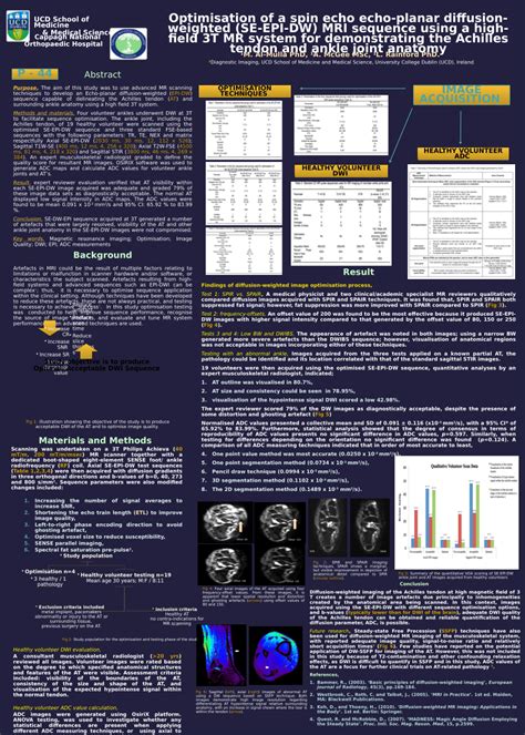 Pdf Optimisation Of A Spin Echo Echo Planar Diffusion Weighted Se