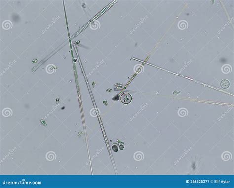 Microalgae Under Microscopic View Green Algae Cyanobacteria