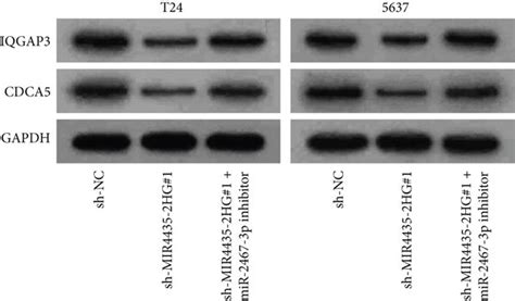 IQGAP3 And CDCA5 Are Downstream Genes Of MiR 2467 3p A Overlap Of