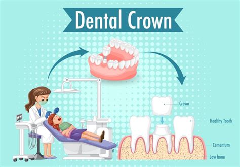 Infographic Of Human In Stages Caries Royalty Free Vector