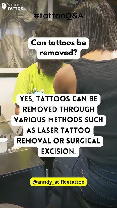 Tattoo Removal Youtube