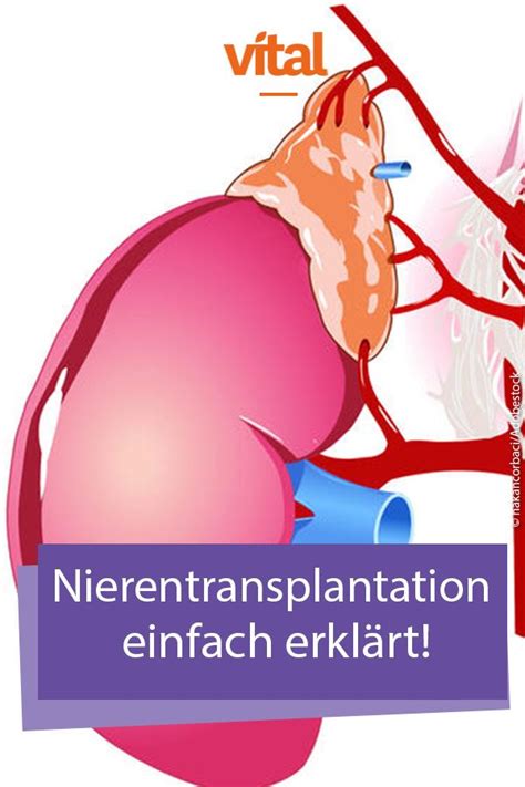 Spenderniere Die Nierentransplantation Kurz Erklärt Nierentransplantation Niere Organspende