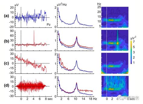 神经时间序列的频域和时频域分析研究的建议和指南 知乎