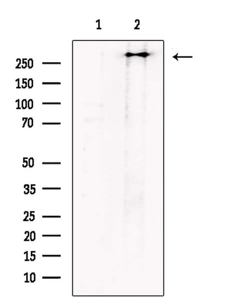 Polycystin 1 Polyclonal Antibody Pa5 115779