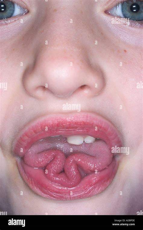 Tongue Rolling Is A Genetically Controlled Trait Stock Photo 3418845