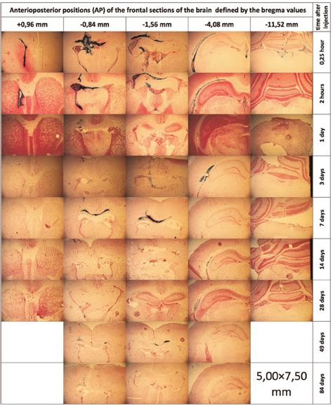 Cross Sections Of Rat Brains At Different Depths Are Shown At Different