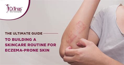 The Ultimate Guide To Building A Skincare Routine For Eczema Prone Skin