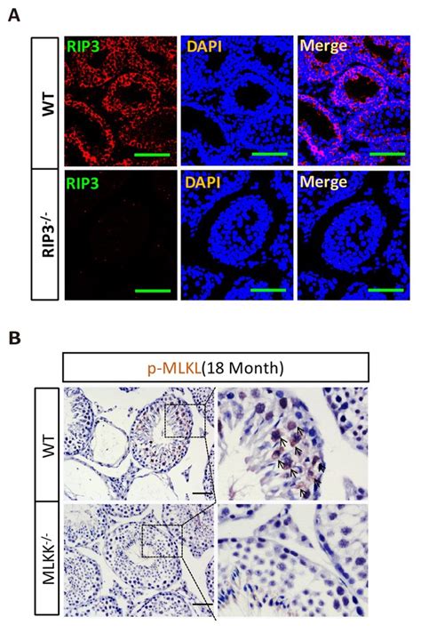 Figures And Data In Ripk1 Ripk3 Mlkl Dependent Necrosis Promotes The