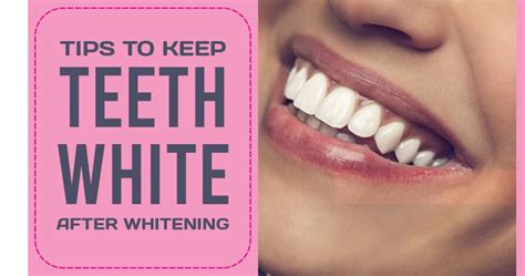 How To Keep Your Teeth White After Whitening Treatment