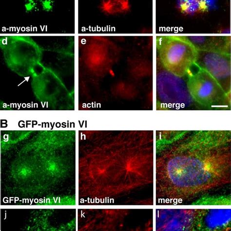 Overexpression Of The Dominantnegative Myosin VI Tail Inhibits