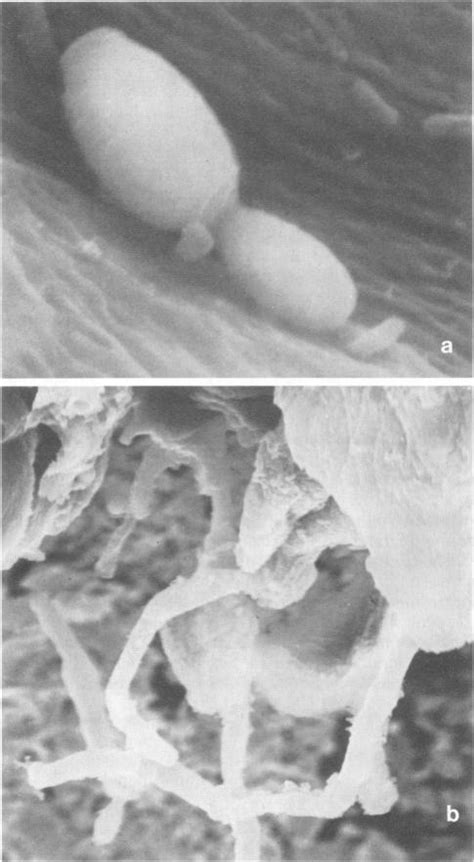 Critical Role Of Germ Tube Formation In The Pathogenesis Of Candidal