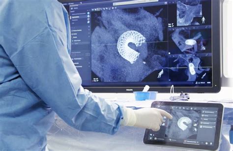 Fda Clears Philips Smart Ct Application Software Massdevice