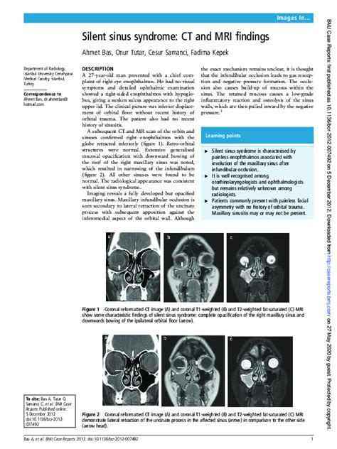 Pdf Silent Sinus Syndrome Ct And Mri Findings Ahmet Can Bas