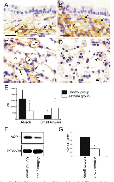 Figure From Changes In Water Channel Aquaporin And Aquaporin In