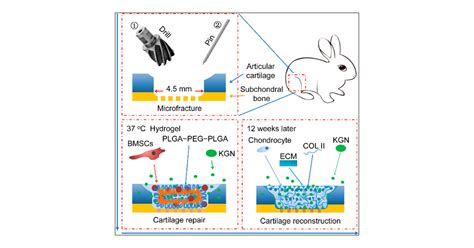 Kartogenin Incorporated Thermogel Supports Stem Cells For Significant