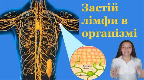 Хронічний застій лімфи в організмі, ознаки як проявляється лімфатичний ...