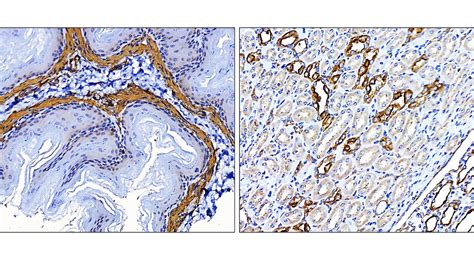 Smooth Muscle Actin Antibody Ir Ireal Biotechnology Inc